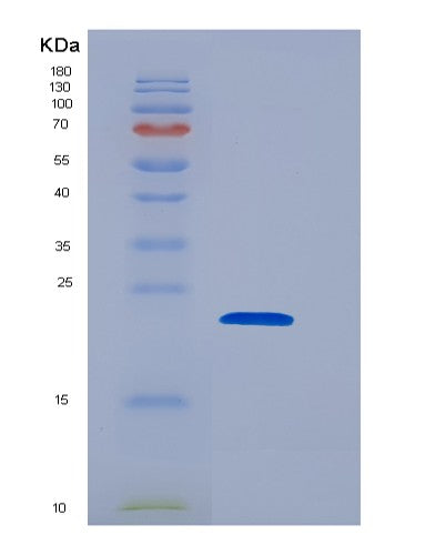SDS-PAGE analysis of Human PPP3R1 (Calcineurin Subunit B Type 1) - Recombinant Protein, showing >85% purity under 15% SDS-PAGE (Reduced)