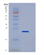 SDS-PAGE analysis of Human PPP3R1 (Calcineurin Subunit B Type 1) - Recombinant Protein, showing >85% purity under 15% SDS-PAGE (Reduced)