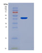 SDS-PAGE analysis of Mouse Ntrk2 (Bdnf/Nt-3 Growth Factors Receptor) - Recombinant Protein, showing >95% purity under 15% SDS-PAGE (Reduced)