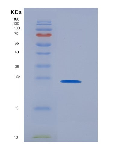 SDS-PAGE analysis of Human TMUB2 (Transmembrane And Ubiquitin-Like Domain-Containing Protein 2) - Recombinant Protein, showing >95% purity under 15% SDS-PAGE (Reduced)