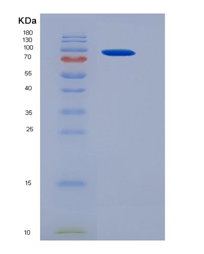SDS-PAGE analysis of Mouse Ncstn (Nicastrin) - Recombinant Protein, showing >95% purity under 15% SDS-PAGE (Reduced)