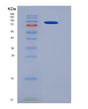 SDS-PAGE analysis of Mouse Ncstn (Nicastrin) - Recombinant Protein, showing >95% purity under 15% SDS-PAGE (Reduced)