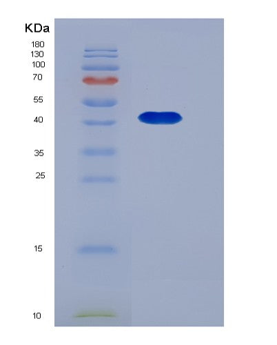SDS-PAGE analysis of Mouse Serpinb8 (Serpin B8) - Recombinant Protein, showing >90% purity under 15% SDS-PAGE (Reduced)