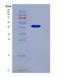 SDS-PAGE analysis of Mouse Serpinb8 (Serpin B8) - Recombinant Protein, showing >90% purity under 15% SDS-PAGE (Reduced)