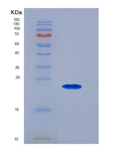 SDS-PAGE analysis of Human EDNRB (Endothelin Receptor Type B) - Recombinant Protein, showing >95% purity under 15% SDS-PAGE (Reduced)