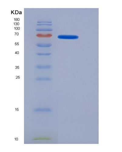 SDS-PAGE analysis of Mouse Mep1a (Meprin A Subunit Alpha) - Recombinant Protein, showing >95% purity under 15% SDS-PAGE (Reduced)