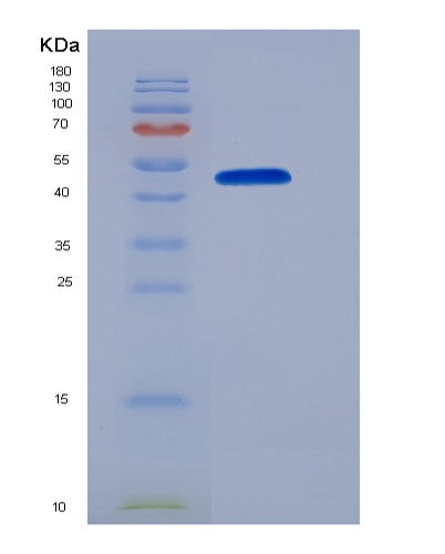 SDS-PAGE analysis of Human CPA1 (Carboxypeptidase A1) - Recombinant Protein, showing >95% purity under 15% SDS-PAGE (Reduced)