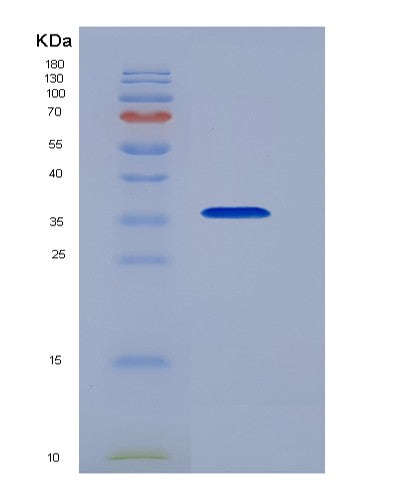 SDS-PAGE analysis of Human NFKBIA (Nf-Kappa-B Inhibitor Alpha) - Recombinant Protein, showing >85% purity under 15% SDS-PAGE (Reduced)