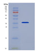 SDS-PAGE analysis of Human NFKBIA (Nf-Kappa-B Inhibitor Alpha) - Recombinant Protein, showing >85% purity under 15% SDS-PAGE (Reduced)