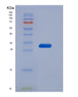 SDS-PAGE analysis of Mouse Cd36 (Platelet Glycoprotein 4) - Recombinant Protein, showing >95% purity under 15% SDS-PAGE (Reduced)