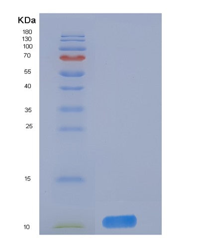 SDS-PAGE analysis of Human DNAJC30 (Dnaj Homolog Subfamily C Member 30, Mitochondrial) - Recombinant Protein, showing >90% purity under 15% SDS-PAGE (Reduced)