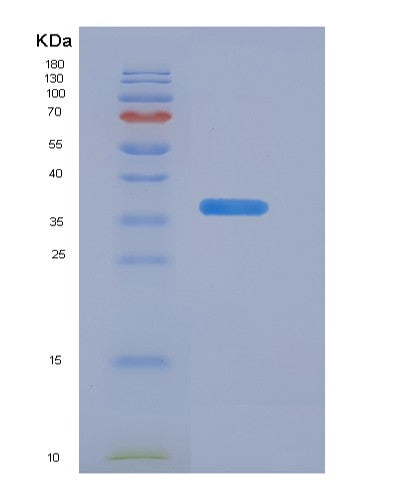 SDS-PAGE analysis of Human CALCB (Calcitonin Gene-Related Peptide 2) - Recombinant Protein, showing >95% purity under 15% SDS-PAGE (Reduced)