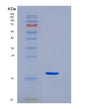 SDS-PAGE analysis of Human KCT2 (Keratinocyte-Associated Transmembrane Protein 2) - Recombinant Protein, showing >90% purity under 15% SDS-PAGE (Reduced)