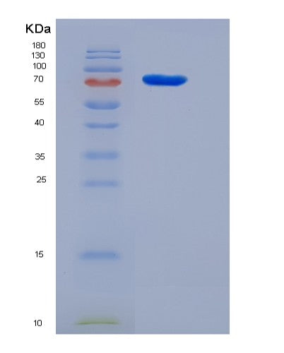SDS-PAGE analysis of Human PRC1 (Protein Regulator Of Cytokinesis 1) - Recombinant Protein, showing >85% purity under 15% SDS-PAGE (Reduced)