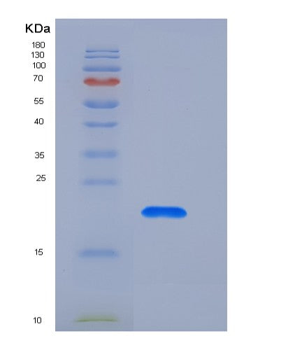 SDS-PAGE analysis of Human CNPY2 (Protein Canopy Homolog 2) - Recombinant Protein, showing >90% purity under 15% SDS-PAGE (Reduced)