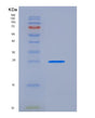 SDS-PAGE analysis of Mouse Il10rb (Interleukin-10 Receptor Subunit Beta) - Recombinant Protein, showing >95% purity under 15% SDS-PAGE (Reduced)