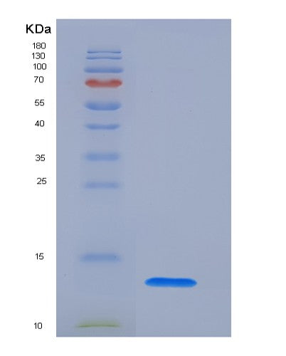 SDS-PAGE analysis of Human SLPI (Antileukoproteinase) - Recombinant Protein, showing >90% purity under 15% SDS-PAGE (Reduced)