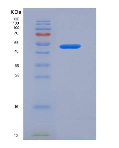 SDS-PAGE analysis of Mouse Il10rb (Interleukin-10 Receptor Subunit Beta) - Recombinant Protein, showing >85% purity under 15% SDS-PAGE (Reduced)