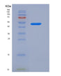 SDS-PAGE analysis of Mouse Il10rb (Interleukin-10 Receptor Subunit Beta) - Recombinant Protein, showing >85% purity under 15% SDS-PAGE (Reduced)