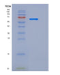 SDS-PAGE analysis of Human FAM171B (Protein Fam171B) - Recombinant Protein, showing >90% purity under 15% SDS-PAGE (Reduced)