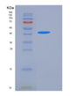 SDS-PAGE analysis of Human CD8B (T-Cell Surface Glycoprotein Cd8 Beta Chain) - Recombinant Protein, showing >85% purity under 15% SDS-PAGE (Reduced)