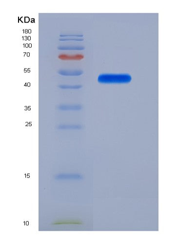 SDS-PAGE analysis of Human LRP10 (Low-Density Lipoprotein Receptor-Related Protein 10) - Recombinant Protein, showing >95% purity under 15% SDS-PAGE (Reduced)