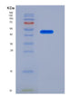 SDS-PAGE analysis of Human LRP10 (Low-Density Lipoprotein Receptor-Related Protein 10) - Recombinant Protein, showing >95% purity under 15% SDS-PAGE (Reduced)