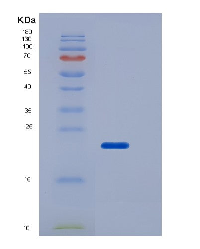 SDS-PAGE analysis of Human FCGR2B (Low Affinity Immunoglobulin Gamma Fc Region Receptor Ii-B) - Recombinant Protein, showing >85% purity under 15% SDS-PAGE (Reduced)