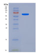 SDS-PAGE analysis of Human KMT5C (Histone-Lysine N-Methyltransferase Kmt5C) - Recombinant Protein, showing >85% purity under 15% SDS-PAGE (Reduced)