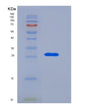 SDS-PAGE analysis of Human RPE (Ribulose-Phosphate 3-Epimerase) - Recombinant Protein, showing >95% purity under 15% SDS-PAGE (Reduced)