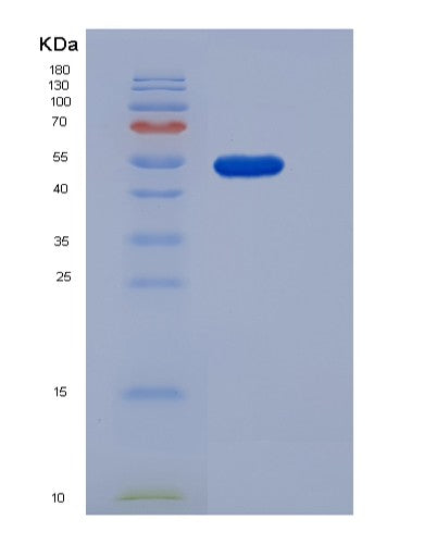 SDS-PAGE analysis of Human PNLIP (Pancreatic Triacylglycerol Lipase) - Recombinant Protein, showing >85% purity under 15% SDS-PAGE (Reduced)