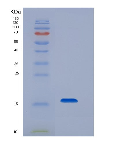 SDS-PAGE analysis of Mouse Cd79b (B-Cell Antigen Receptor Complex-Associated Protein Beta Chain) - Recombinant Protein, showing >95% purity under 15% SDS-PAGE (Reduced)