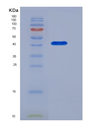 SDS-PAGE analysis of Mouse Cd28 (T-Cell-Specific Surface Glycoprotein Cd28) - Recombinant Protein, showing >85% purity under 15% SDS-PAGE (Reduced)
