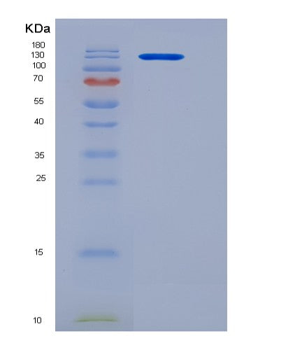 SDS-PAGE analysis of Human CSN3 (Kappa-Casein) - Recombinant Protein, showing >90% purity under 15% SDS-PAGE (Reduced)