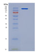 SDS-PAGE analysis of Human CSN3 (Kappa-Casein) - Recombinant Protein, showing >90% purity under 15% SDS-PAGE (Reduced)