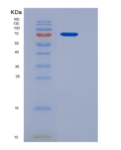 SDS-PAGE analysis of Mouse Ltf (Lactotransferrin) - Recombinant Protein, showing >85% purity under 15% SDS-PAGE (Reduced)
