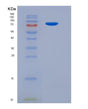 SDS-PAGE analysis of Human PDE3A (Cgmp-Inhibited 3',5'-Cyclic Phosphodiesterase 3A) - Recombinant Protein, showing >85% purity under 15% SDS-PAGE (Reduced)