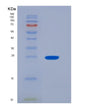 SDS-PAGE analysis of Human PSPH (Phosphoserine Phosphatase) - Recombinant Protein, showing >85% purity under 15% SDS-PAGE (Reduced)