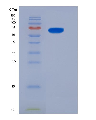 SDS-PAGE analysis of Mouse Il13ra1 (Interleukin-13 Receptor Subunit Alpha-1) - Recombinant Protein, showing >90% purity under 15% SDS-PAGE (Reduced)