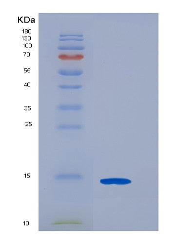 SDS-PAGE analysis of Human CDK2AP2 (Cyclin-Dependent Kinase 2-Associated Protein 2) - Recombinant Protein, showing >95% purity under 15% SDS-PAGE (Reduced)