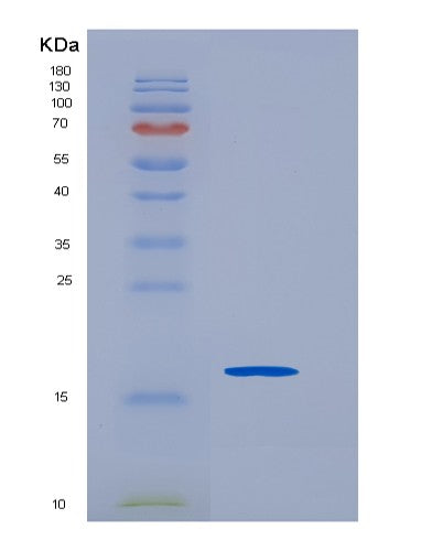 SDS-PAGE analysis of Human SCN3B (Sodium Channel Regulatory Subunit Beta-3) - Recombinant Protein, showing >90% purity under 15% SDS-PAGE (Reduced)