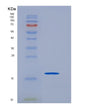 SDS-PAGE analysis of Human SCN3B (Sodium Channel Regulatory Subunit Beta-3) - Recombinant Protein, showing >90% purity under 15% SDS-PAGE (Reduced)