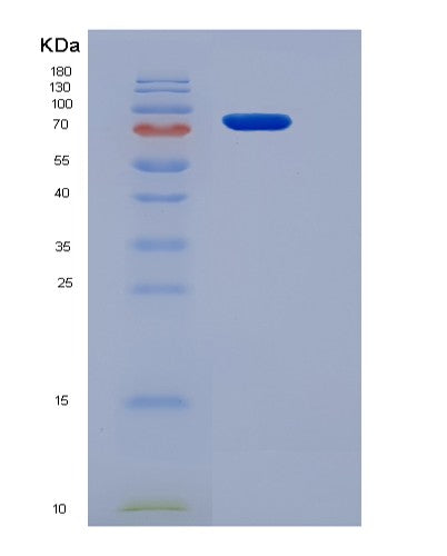 SDS-PAGE analysis of Mouse Smad2 (Mothers Against Decapentaplegic Homolog 2) - Recombinant Protein, showing >85% purity under 15% SDS-PAGE (Reduced)