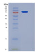 SDS-PAGE analysis of Mouse Smad2 (Mothers Against Decapentaplegic Homolog 2) - Recombinant Protein, showing >85% purity under 15% SDS-PAGE (Reduced)