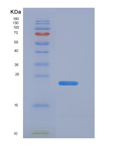 SDS-PAGE analysis of Human TIMP1 (Metalloproteinase Inhibitor 1) - Recombinant Protein, showing >95% purity under 15% SDS-PAGE (Reduced)