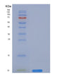 SDS-PAGE analysis of Mouse Cd59a (Cd59A Glycoprotein) - Recombinant Protein, showing >95% purity under 15% SDS-PAGE (Reduced)