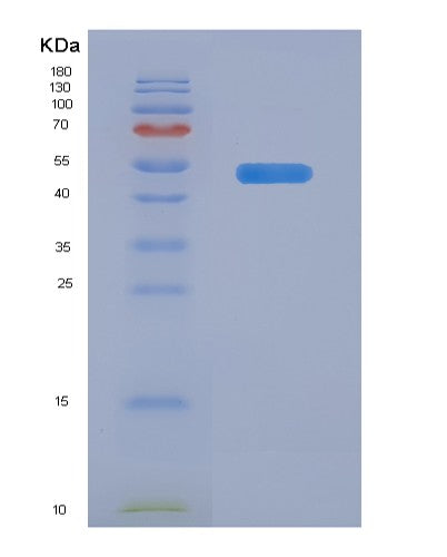 SDS-PAGE analysis of Human LAYN (Layilin) - Recombinant Protein, showing >90% purity under 15% SDS-PAGE (Reduced)