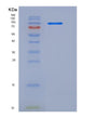 SDS-PAGE analysis of Human CNTN4 (Contactin-4) - Recombinant Protein, showing >90% purity under 15% SDS-PAGE (Reduced)