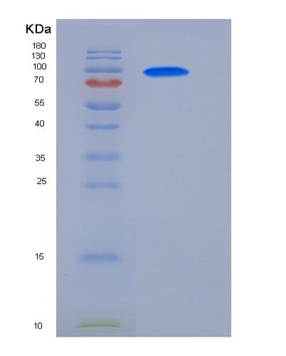 SDS-PAGE analysis of Human GAD2 (Glutamate Decarboxylase 2) - Recombinant Protein, showing >85% purity under 15% SDS-PAGE (Reduced)