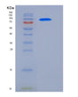 SDS-PAGE analysis of Human GAD2 (Glutamate Decarboxylase 2) - Recombinant Protein, showing >85% purity under 15% SDS-PAGE (Reduced)